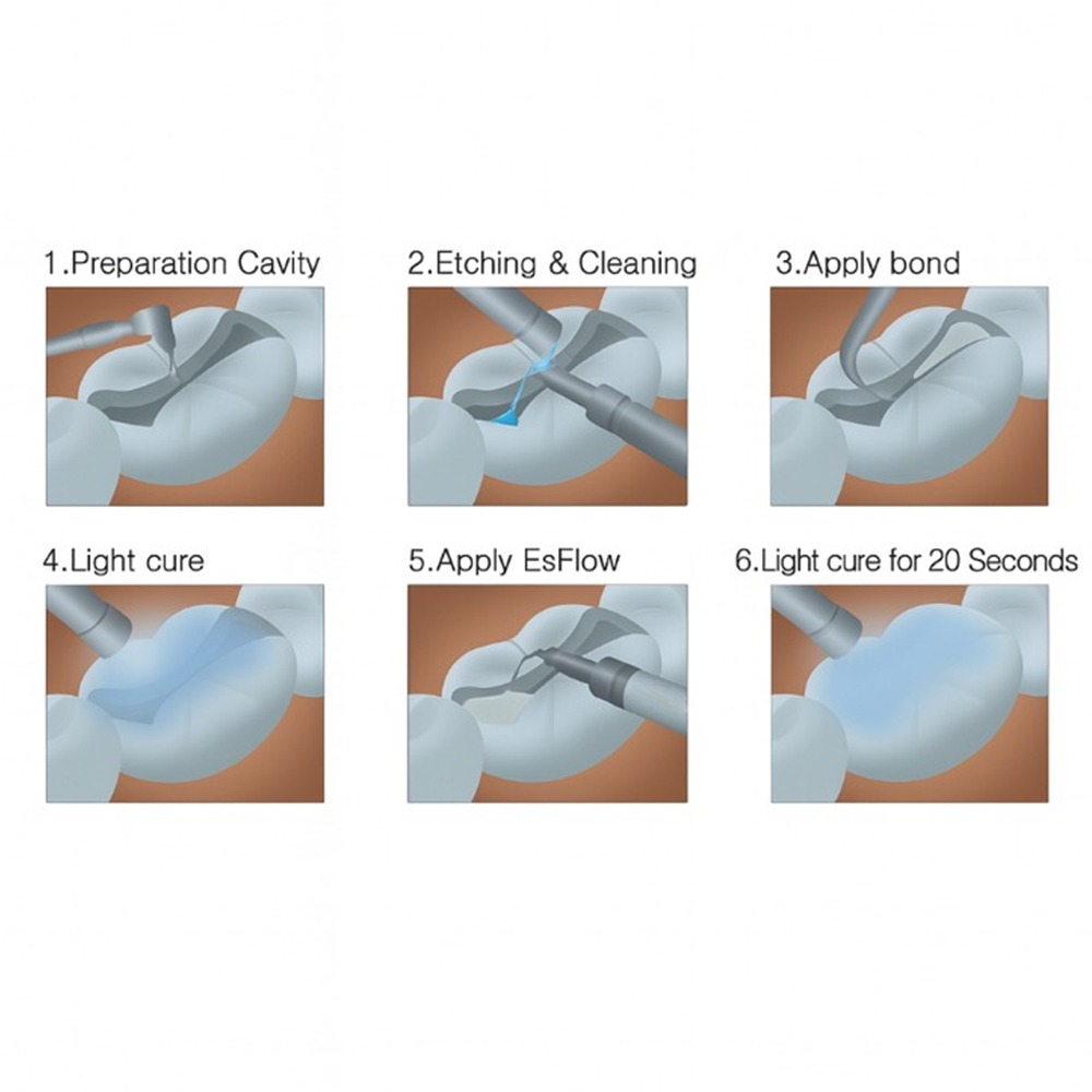 Voco Polofil NHT Flow Flowable Composite Material