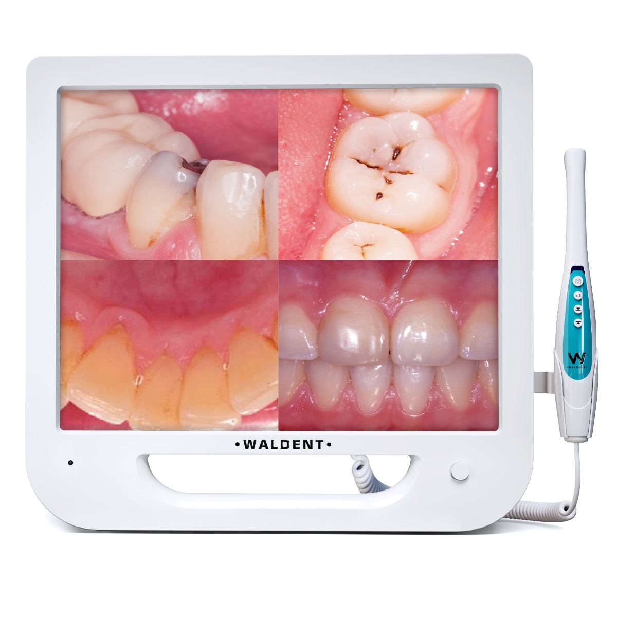 Waldent Intra Oral Camera with Screen - Ergo (10 MP)