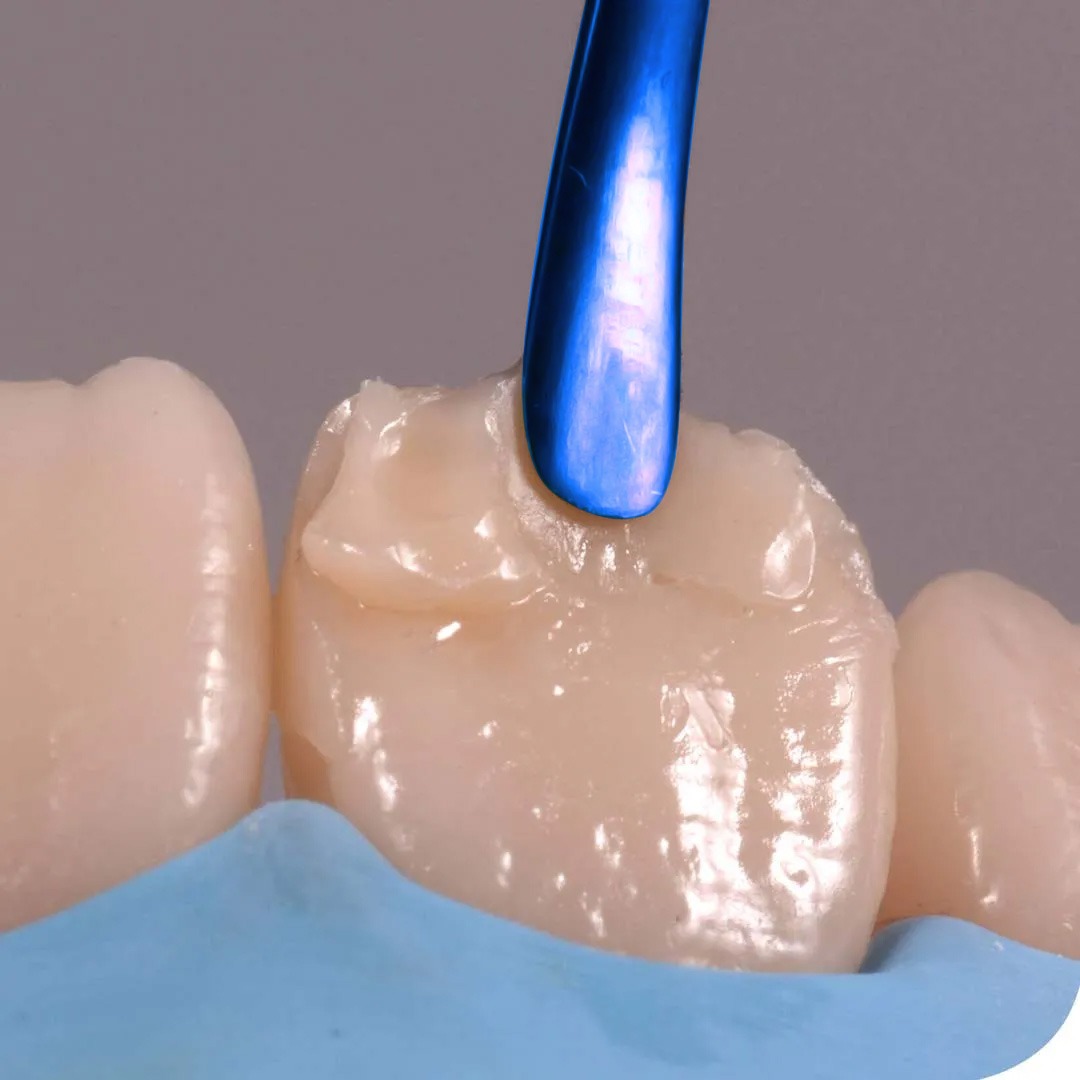 DentGist NanoCom Restorative Composite Refills 4g