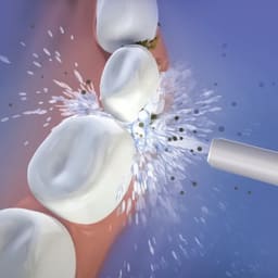 Oracura OC200 Dental PRO Smart Plus Water Flosser - 12