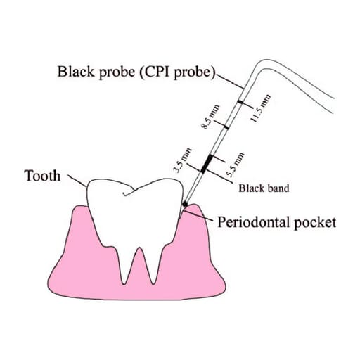 Waldent UNC 15 Probes
