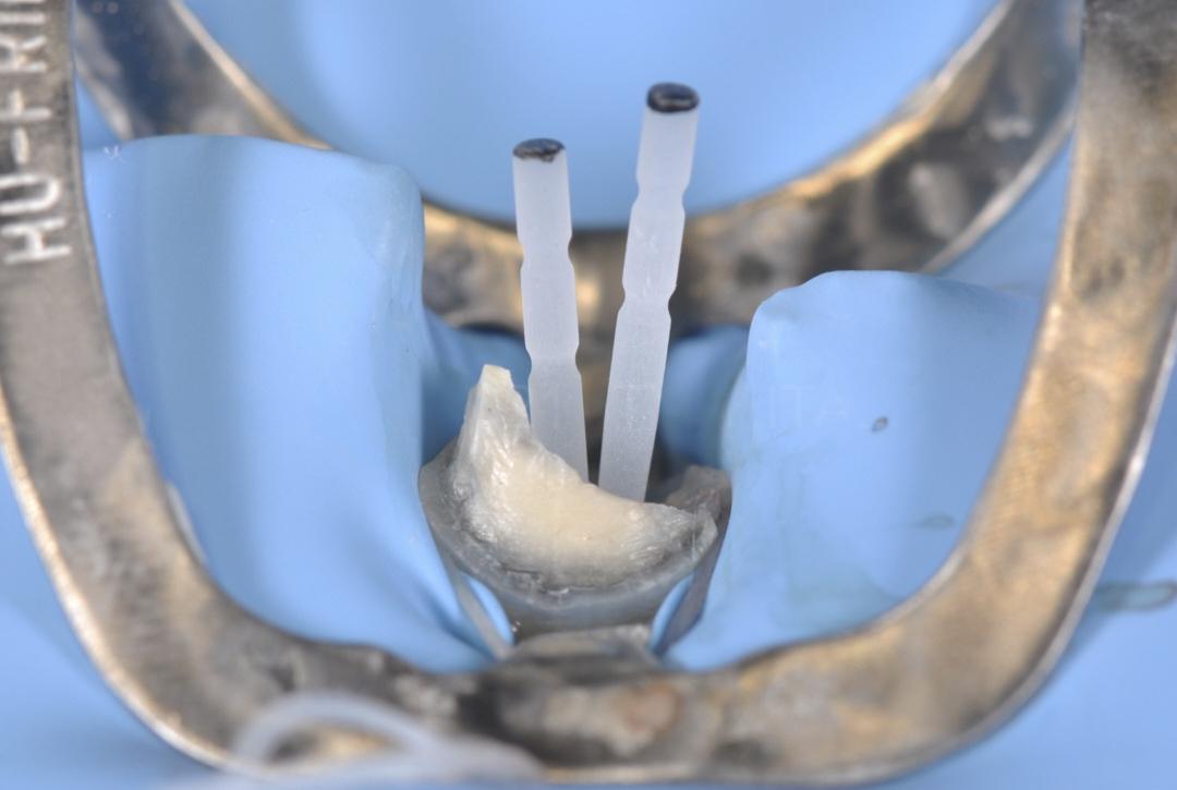 Angelus Reforpost Fibre Glass - Refill