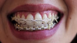 Phyx Elastic Chain - 6