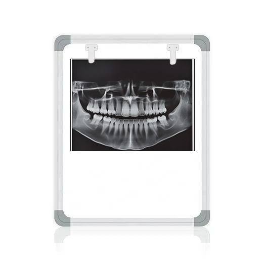 OPG X-Ray Film Viewer - LED