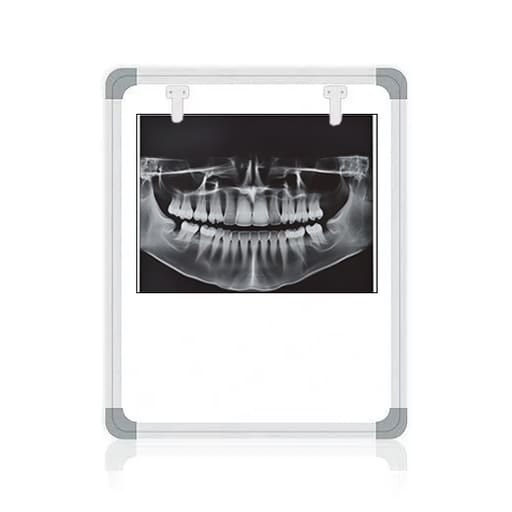 OPG X-Ray Film Viewer - LED
