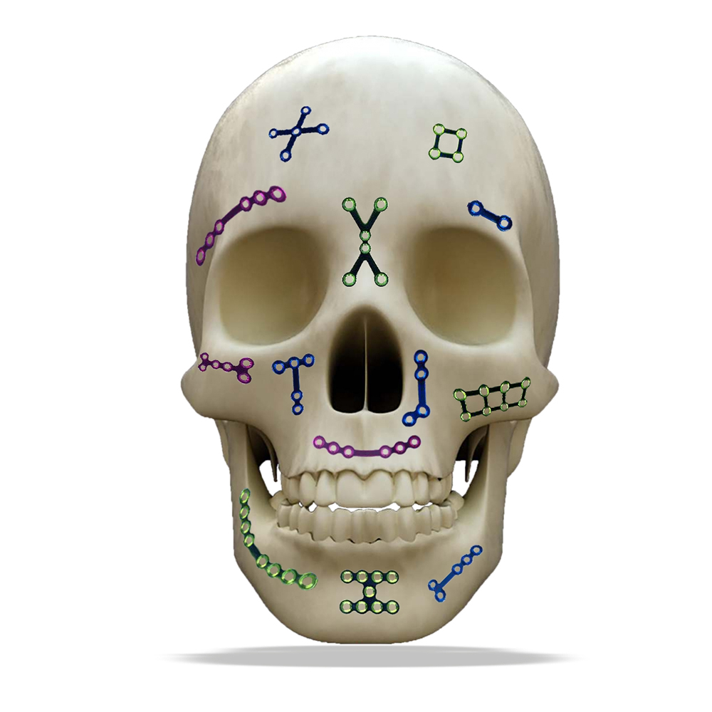 SK Surgicals Titanium Mini Bone Plates T Shape With Gap - 2mm