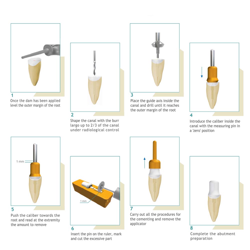 Younique Fiber Site Post Kit