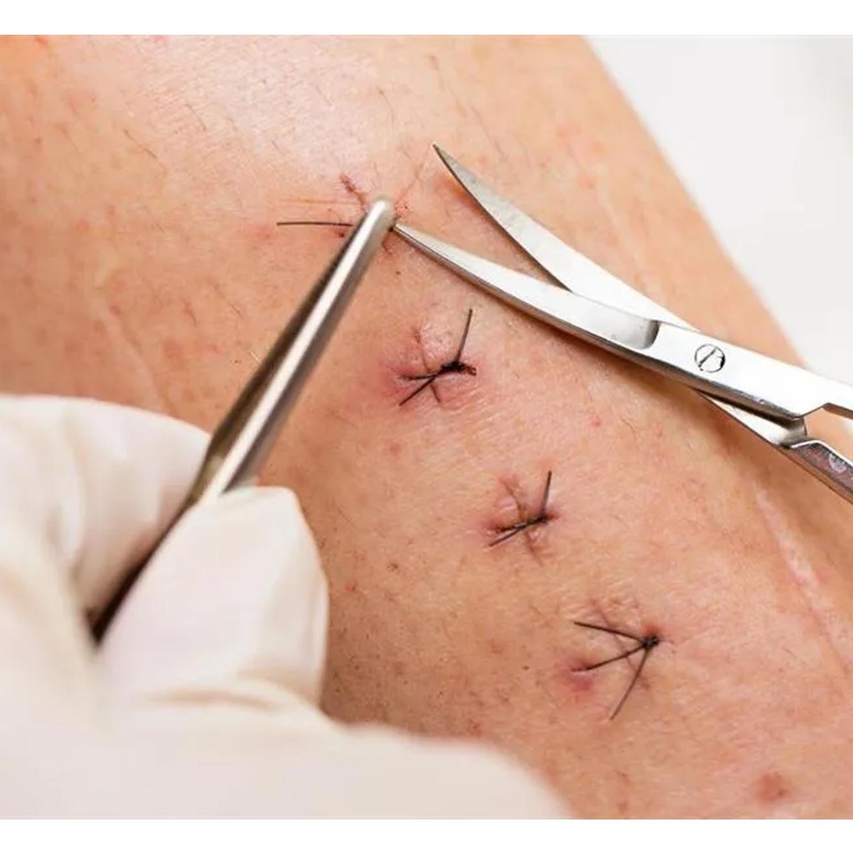 Oracraft Castroviejo Scissors