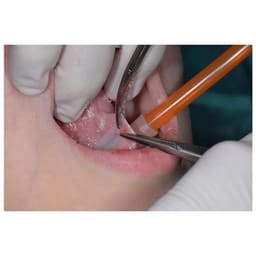 Oracraft Hemostat Kelly - Curved (H2) - 3