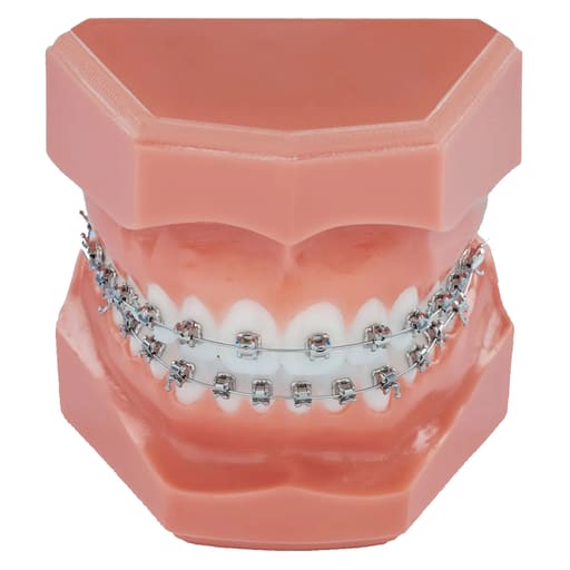 Koden Basic Series MBT Metal Bracket Kits (Normal)