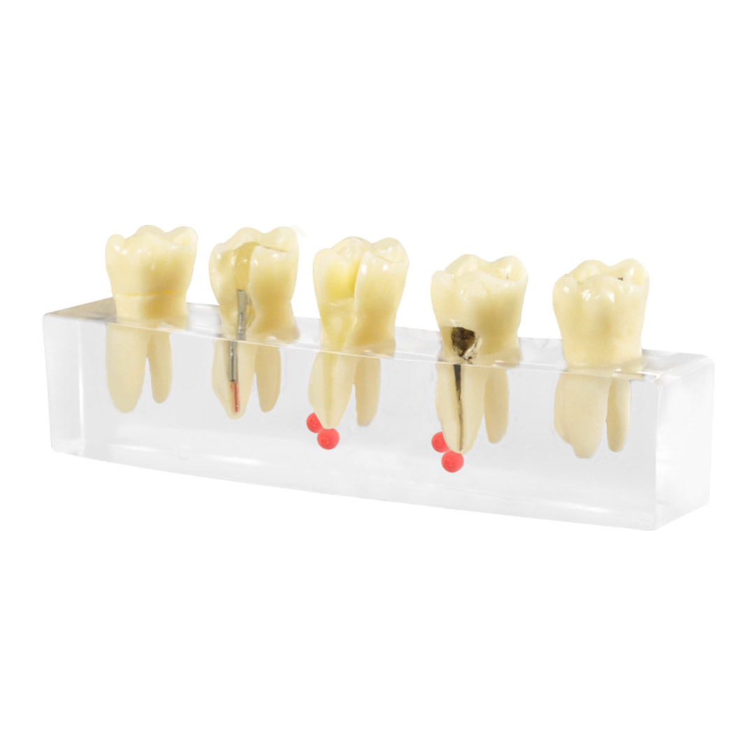 iDENTical Root Canal Model M4012
