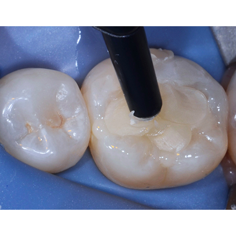 3M ESPE Filtek Z350 XT Universal Restorative Composite Compule Refills