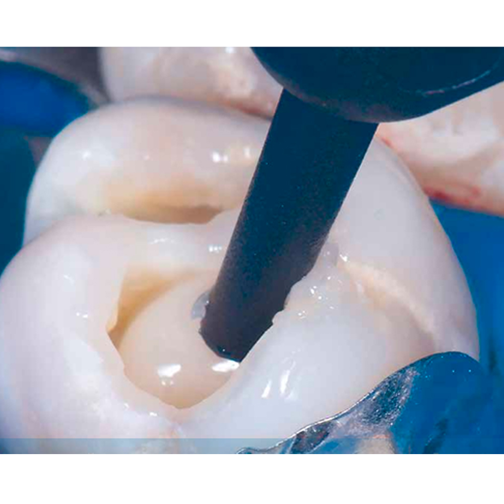 3M ESPE Filtek Z350 XT Universal Restorative Composite Compule Refills