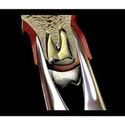 Oracraft  Extraction Forceps Premium - 9