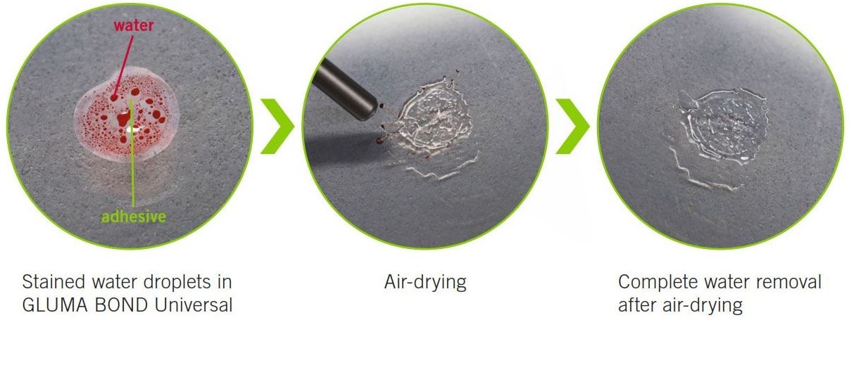 Kulzer Gluma Bond5 4ml